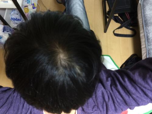 「真剣に髪のことで悩んでます。」の質問画像
