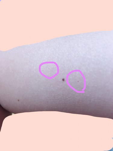 「腕に赤い斑点がありたまに骨が痛い時があり」の質問画像