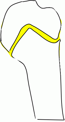 「身長まだ伸びるかの判定方ってありますか?」の回答画像2