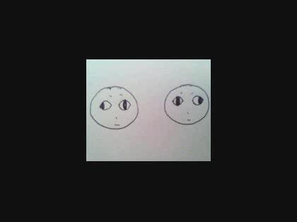 「眼科に詳しい人へ」の質問画像