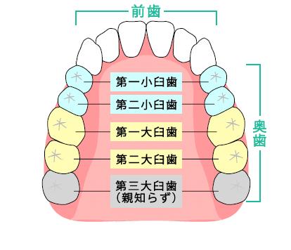 「下の歯の奥に溝があり、痛い。治し方わかり」の回答画像1