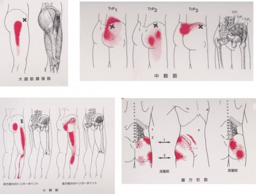 「骨盤?股関節?腰?が痛いです。 画像の場」の回答画像2
