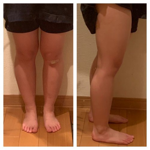 「足が太くて悩んでいます。高一女子です。 」の質問画像