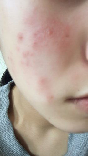 「私は中学3年女子です。 私は中学2年生の」の質問画像