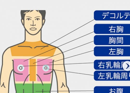 「乳ガンに詳しい方教えてください。 胸と胸」の質問画像