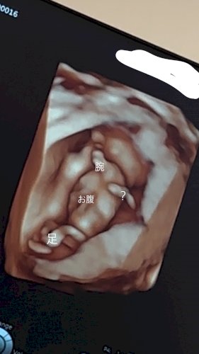 「妊娠中で、4Dエコー初めてみました! お」の質問画像