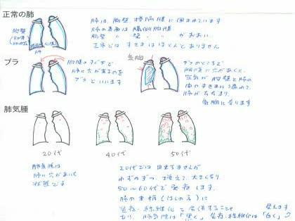 「肺気腫といわれましたがCTで解ります?」の回答画像17