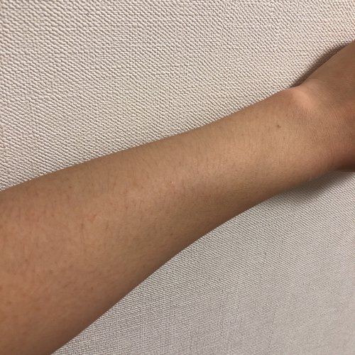 「【脱毛について】 今年で20歳になる女子」の質問画像