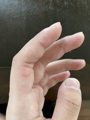 「指が赤く腫れている」の質問画像