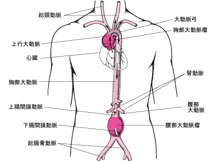 「最近胸が痛いです。 ちょうど乳房と乳房の」の回答画像3