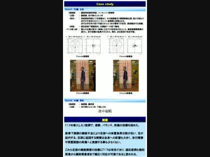 「腰部脊椎管狭窄症の手術後の状態」の回答画像3