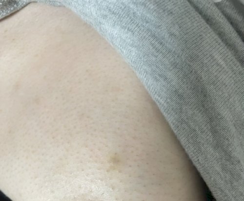 「乳がんの可能性」の質問画像