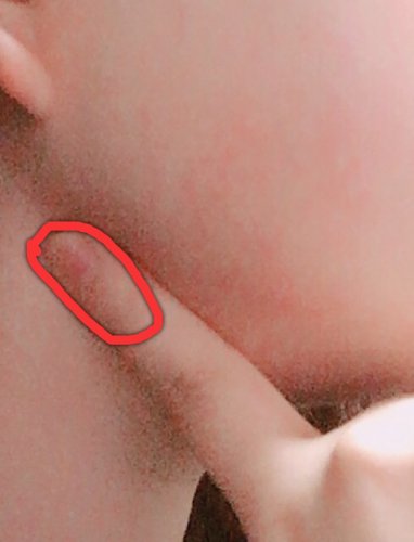「写真を貼るのを忘れてしまったのでもう一度」の質問画像