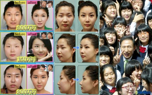 「朝鮮人って整形しないとブスなんですか? 」の回答画像3