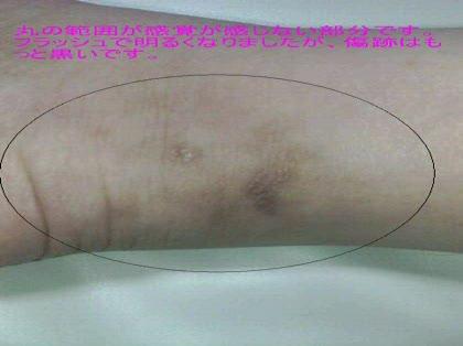 「事故の被害者で、後遺症認定にについて」の質問画像