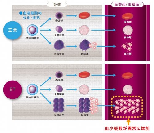 「血小板血症の薬について」の回答画像3