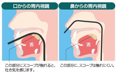 「胃カメラの入口で」の回答画像2