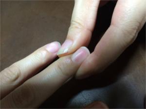 日向ぼっこをしながらガムを噛む?冬季うつ病の「やさしい」ケア方法