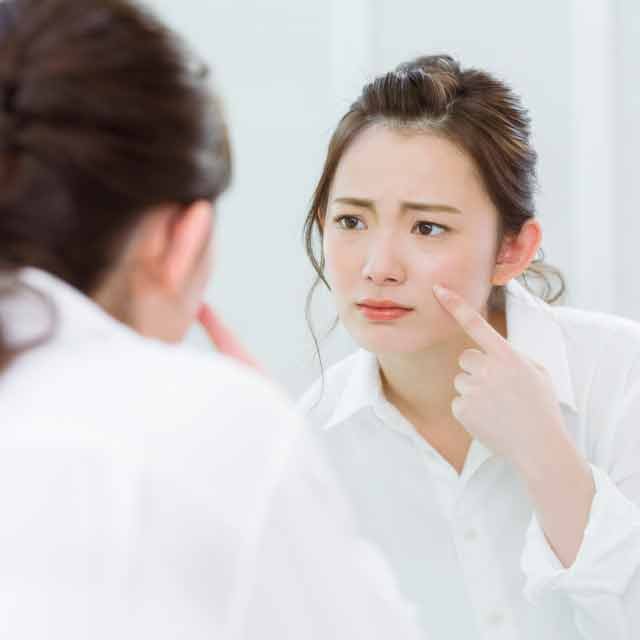 思春期ニキビと大人ニキビ、何か違うの?専門家に聞いてみた