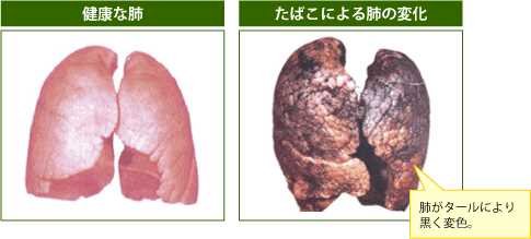 「何百回も禁煙失敗して、そのつどここで質問」の回答画像8