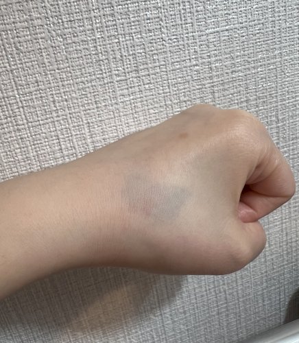 「昼寝から起きたら手の甲にアザのようなもの」の質問画像