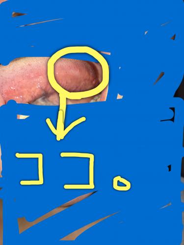 「先程舌のふちを見てみたら少し白い気がして」の質問画像