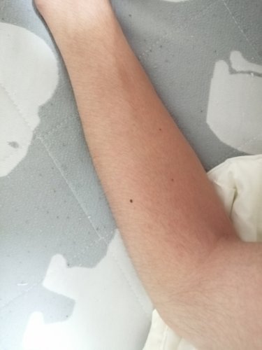 「男子大学生です。このレベルの腕毛？ってそ」の質問画像