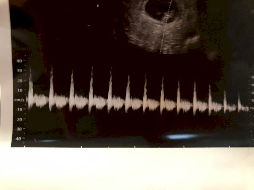 「こんにちは。 現在8週4日の妊婦です。 」の質問画像