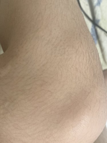 「女性でこのムダ毛はおかしいですか？ 20」の質問画像