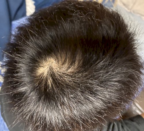 「28歳男です。 この頭頂部は禿げてきてま」の質問画像