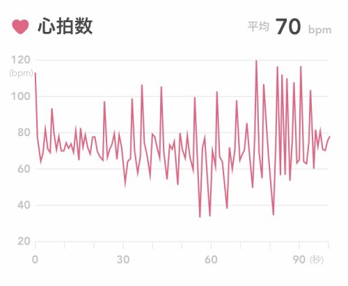 「不整脈 この脈のグラフは不整脈ですか？ 」の質問画像