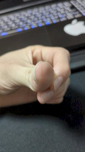 「親指に小さくて茶色い斑点がいっぱいある。」の質問画像