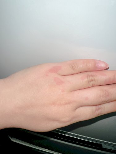 「ぶつけてもないのに、突然こんなのが 何か」の質問画像