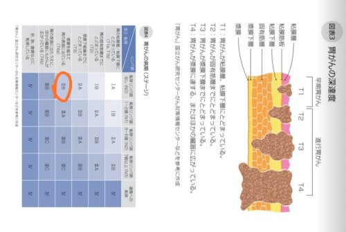 「73歳の父が胃癌になり、胃の出口側3分の」の質問画像