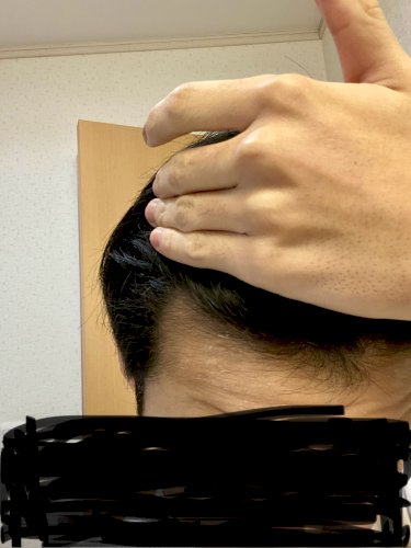 「現在20歳で約4ヶ月前から個人輸入でミノ」の質問画像
