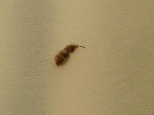 虫に刺されました 針 が残りました 昨年の夏頃に 脚のももが痒く 怪我 教えて Goo 虫に刺されました 針 が残りました 昨年の夏頃に 脚のももが痒く 怪我 教えて Goo