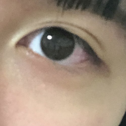 瞼の生え際が見えないむっちり したような二重なんですけど どうした その他 健康 美容 ファッション 教えて Goo 瞼の生え際が見えないむっちり したような二重なんですけど どうした その他 健康 美容 ファッション 教えて Goo