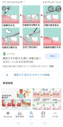 「親知らずってずっーと抜かないとどうなりま」の補足画像1