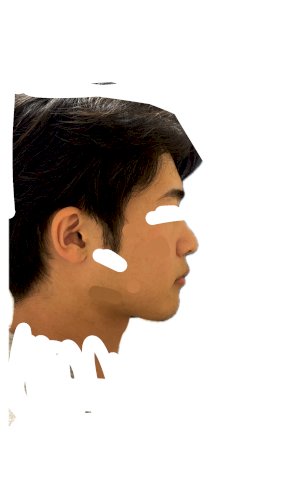 「中顔面」の質問画像