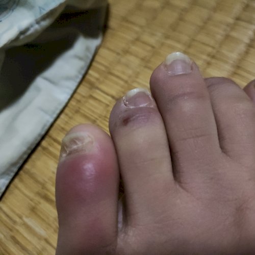 「足の指先の黒い点、これが何なのか心当たり」の質問画像