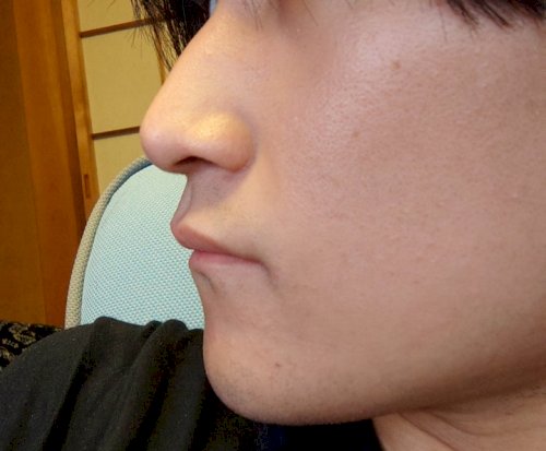 「Eラインどうでしょうか これって歯並び悪」の質問画像
