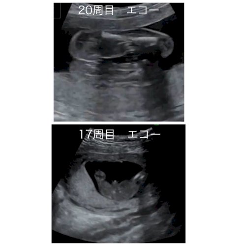 「エコー写真 男の子から女の子へ？」の質問画像