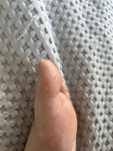 「これは水虫ですか？」の質問画像