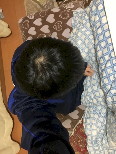 「つむじはげですか？」の質問画像