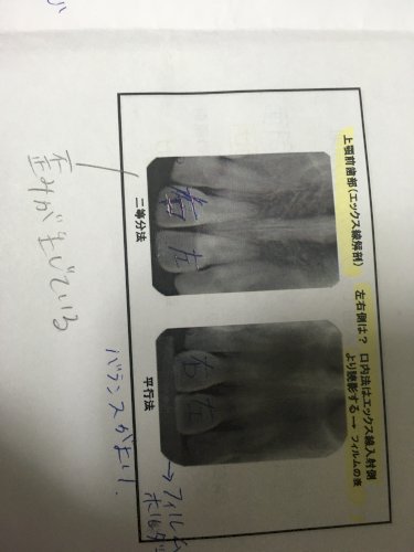 「今歯科衛生士の学校に通っているものです。」の質問画像