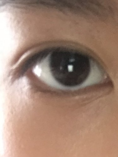 「これって二重なんですか？ 友達に二重いい」の補足画像1
