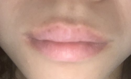 最近唇の上が黒ずんでいるのが気になります これはどうしてなるのでし その他 メイク 美容 教えて Goo