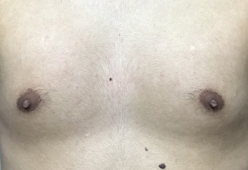 「汚い画像すみません、これって胸毛濃いです」の質問画像