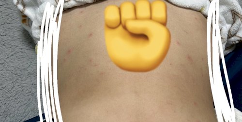 「【閲覧注意】 背中の上あたりと、お腹周り」の質問画像