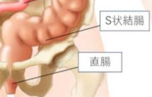 「左下下腹部が痛い」の質問画像